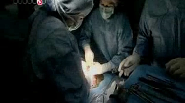 Accouchement : quand pratique-t-on une anesthésie générale ?