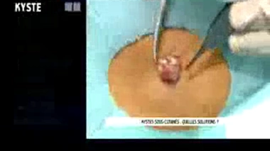 Zapping du 03/10/2014