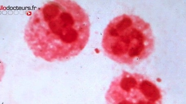 Méningite foudroyante : un homme de 27 ans meurt à Nancy