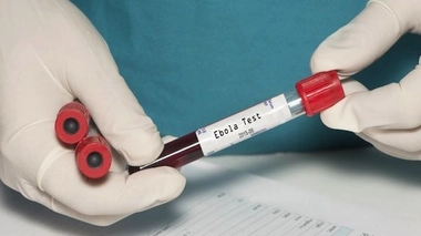 Ebola : l'Europe et les Etats-Unis renforcent leur vigilance (Photo :© Sherry Young LPN - Fotolia.com)