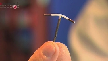 Cinq questions sur les stérilets hormonaux et au cuivre