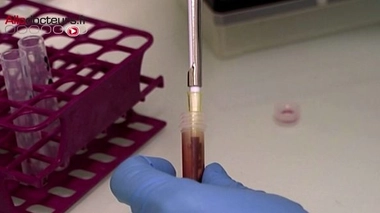 Ebola : décès d'un employé de l'ONU soigné en Allemagne