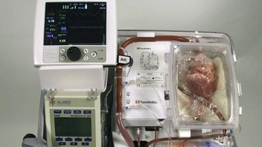 Le dispositif employé pour empêcher la dégradation des cœurs en attendant leur transplantation. (DR)