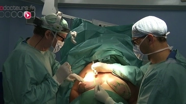 Cancer du sein : un petit pas du Sénat sur la reconstruction mammaire