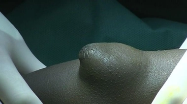 Les anomalies digestives des enfants