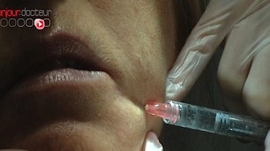 Tourisme médical et faux praticiens dans le collimateur des chirurgiens esthétiques