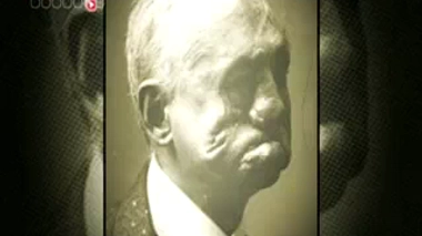 Le loto des gueules cassées - Reportage diffusé le 27 juin 2014.