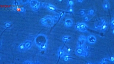 La transmission du virus Ebola par le sperme possible jusqu'à 82 jours