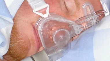 Apnée du sommeil : le remboursement ne sera pas conditionné à l'observance du traitement - Dispositif PPC (cc-by-sa Michaelsy)