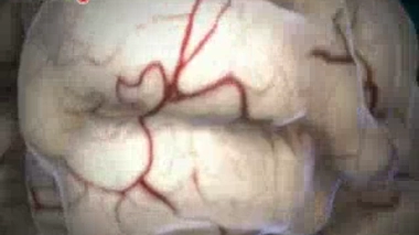 Alzheimer : découverte d'une nouvelle enzyme tueuse de neurones