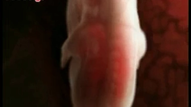 Plus besoin d'attendre après une fausse couche pour retenter une grossesse