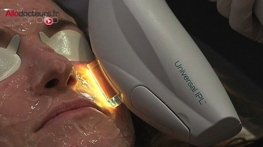 Epilation par lumière pulsée : cinq esthéticiennes condamnées