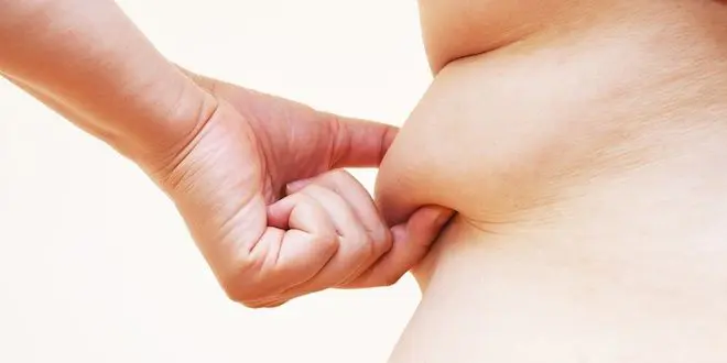 Le nombre de personnes en surpoids ou obèses a augmenté en France depuis dix ans.