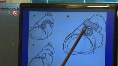 Dans le coeur des nourrissons : les malformations cardiaques à la naissance