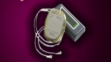 Un stimulateur nerveux contre la prise de poids : l'implant Maestro Rechargeable System (crédits :  EnteroMedics)