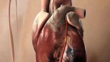 Ch@t : Les troubles du rythme cardiaque