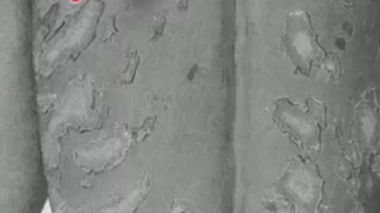 Retour sur l'histoire des traitements médicaux mais aussi sociaux des lépreux.