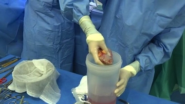 Du lundi 26 janvier 2015 au vendredi 30 janvier 2015, retrouvez la série In vivo