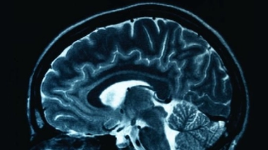 ''Les épileptiques sont encore trop souvent pris pour des fous''