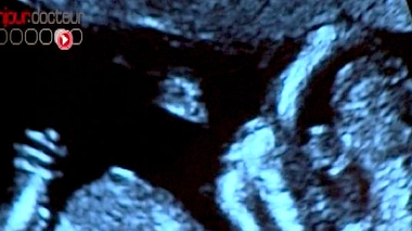 Image d'illustration