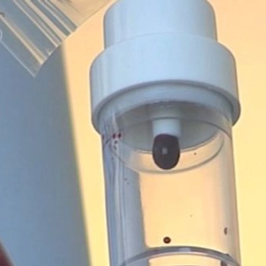 Tout savoir sur les transfusions sanguines