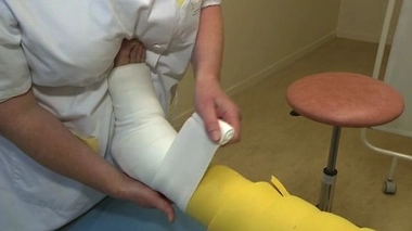 Syndrome des grosses jambes : quelle prise en charge ?