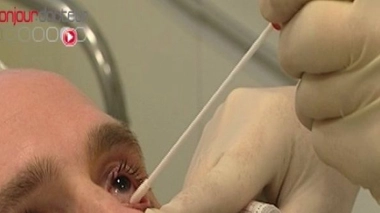 Ch@t : Conjonctivites et kératites