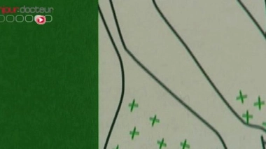 Ch@t : Les vergetures