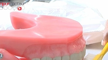 Dentiers : quand la vie retrouve son mordant