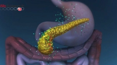 Aux Etats-Unis, 53.670 nouveaux cas de cancer du pancréas seront diagnostiqués en 2017 et plus de 43.000 personnes en décéderont.