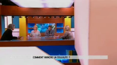 Cellulite : la cryolipolyse est-elle efficace ?