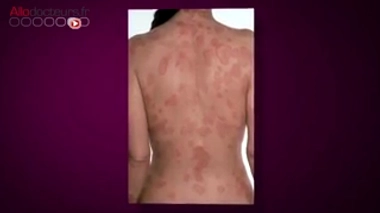 Allergies : le stylo qui peut sauver des vies