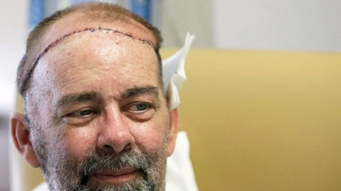 Le bénéficiaire de la greffe (droits réservés)