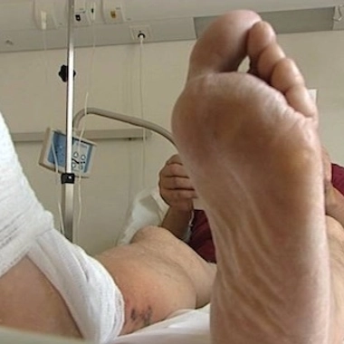 Diabète de type II : des complications redoutables