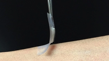 Le patch est recouvert d'une centaine d'aiguilles microscopiques contenant de l'insuline 