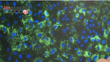 Cellules souches induites : une nouvelle avancée