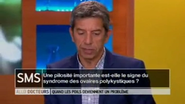 L'hyperpilosité est-elle le signe du syndrome des ovaires polykystiques ?
