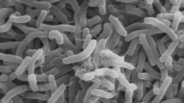 Cholera bacteria SEM  - Wikimedia Commons