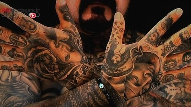 La migration de l'encre de tatouage peut induire des erreurs d'interprétation d'images médicaless