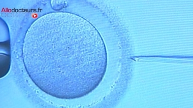 PMA : les Australiens bientôt autorisés à choisir le sexe de l'enfant ?