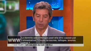 Maladies du cuir chevelu : cause et traitement de la dermite séborrhéique ?