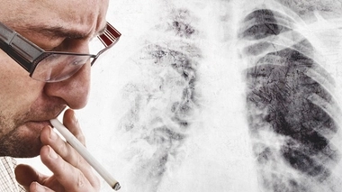 BPCO : les fumeurs ne sont pas tous égaux