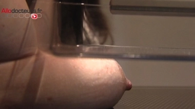 Cancer du sein : dépistage gratuit étendu aux femmes à risques