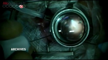 Produit ophtalmique suspect : qui est responsable ?