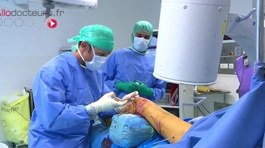 Allongement des jambes : pour gagner des centimètres