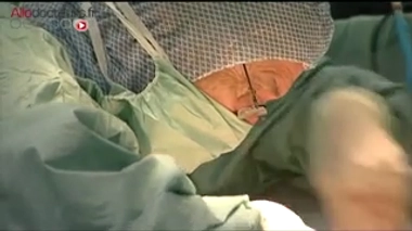 Illustration : affichage d'écran d'EchoNavigator, le logiciel utilisé lors de l'intervention. (crédits : Philips Healthcare). Vidéo : "Opérés à cœur fermé grâce à la 3D", reportage diffusé dans "Le magazine de la santé" du 7 décembre 2015.