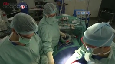 Attention images de chirurgie !