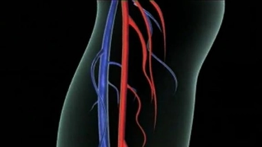 Ch@t : L'insuffisance veineuse