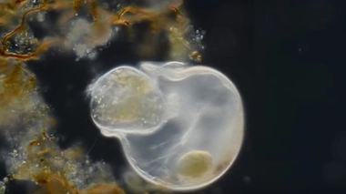 Trachelius cilié absorbant un Campanela cilié (par Wim van Egmond, premier prix du concours)