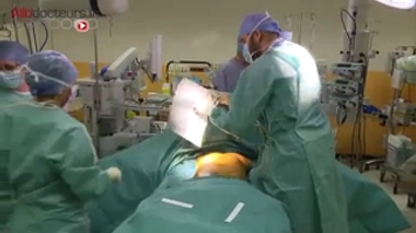 Attention images de chirurgie ! Reconstruire un sein sans prothèse, c'est possible